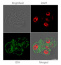 IDH | Isocitrate dehydrogenase (Cellular [compartment marker] of mitochondrial matrix)